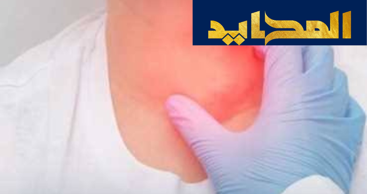 هل يعتبر تضخم الغدة الدرقية خطير؟
