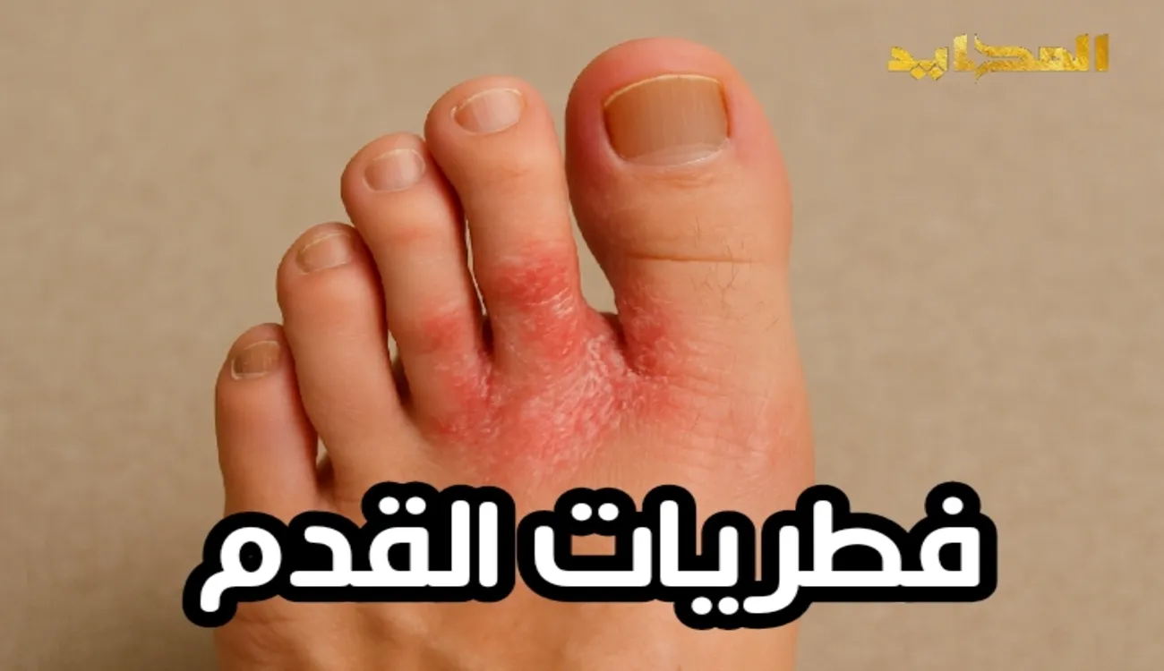 فطريات القدم.. خطر يهدد صحة قدميك