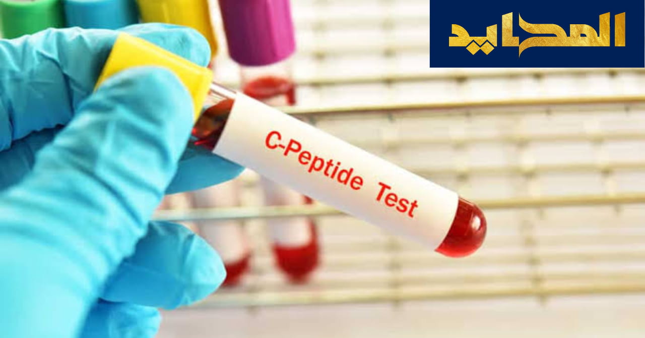 أهمية تحليل C-peptide فى معرفة داء السكري
